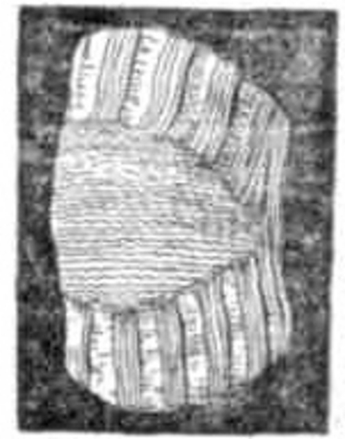 A Knitted Knee-Cap