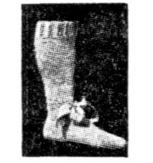 Bedsocks for Cold Toes