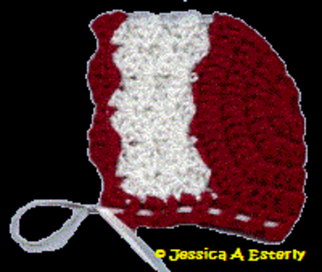 Christmas Shell Bonnet