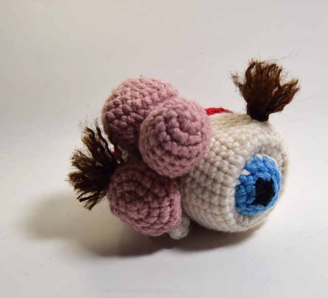 Teratoma Tumor