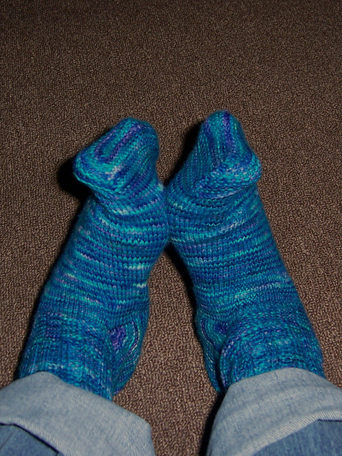 Plantar Fasciitis