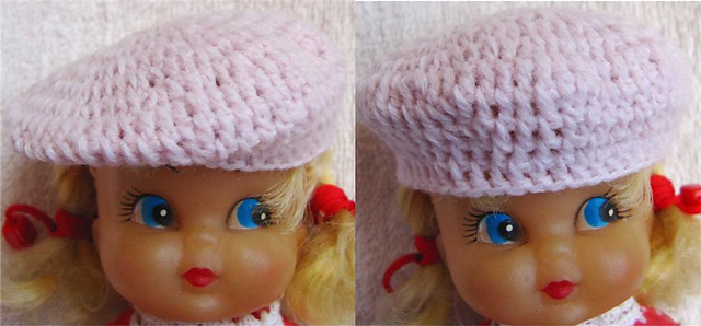 Beret 1 – Normal